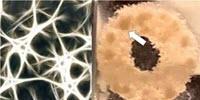 Scientists Create Brain-Mimicking Environment to Grow 3D Tissue Models of Brain Tumors