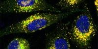 When Added to Gene Therapy, Plant-Based Compound May Enable Faster, More Effective Treatments