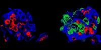 'Super-Grafts' That Could Treat Diabetes