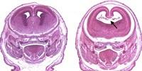 CBD, THC Use during Early Pregnancy Can Disrupt Fetal Development