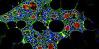 Milk from Teeth: Dental Stem Cells Can Generate Milk-Producing Cells