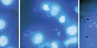 Preventing Cell Culture Contamination