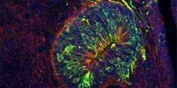 Scientists Identify New Puberty-Promoting Genes