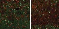Eating More Ketones May Help Fight Alzheimer's Disease