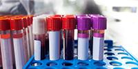 Blood Tests Can Predict Timing of Final Menstrual Period